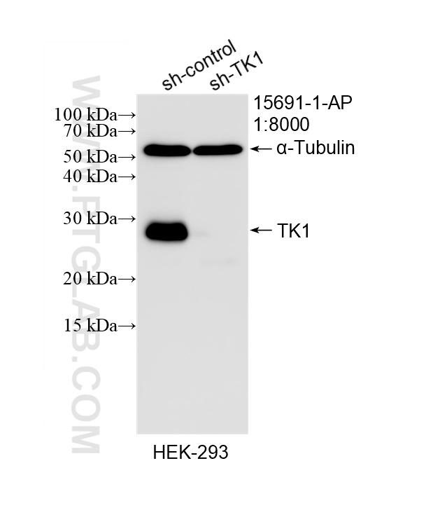 WB result of TK1 antibody (15691-1-AP; 1:8000; incubated at room temperature for 1.5 hours) with sh-Control and sh-TK1 transfected HEK-293 cells. WB analysis of HEK-293 using 15691-1-AP