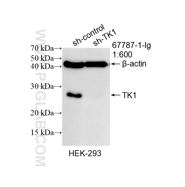 WB result of TK1 antibody (67787-1-Ig; 1:600; incubated at room temperature for 1.5 hours) with sh-Control and sh-TK1 transfected HEK-293 cells. WB analysis of HEK-293 using 67787-1-Ig