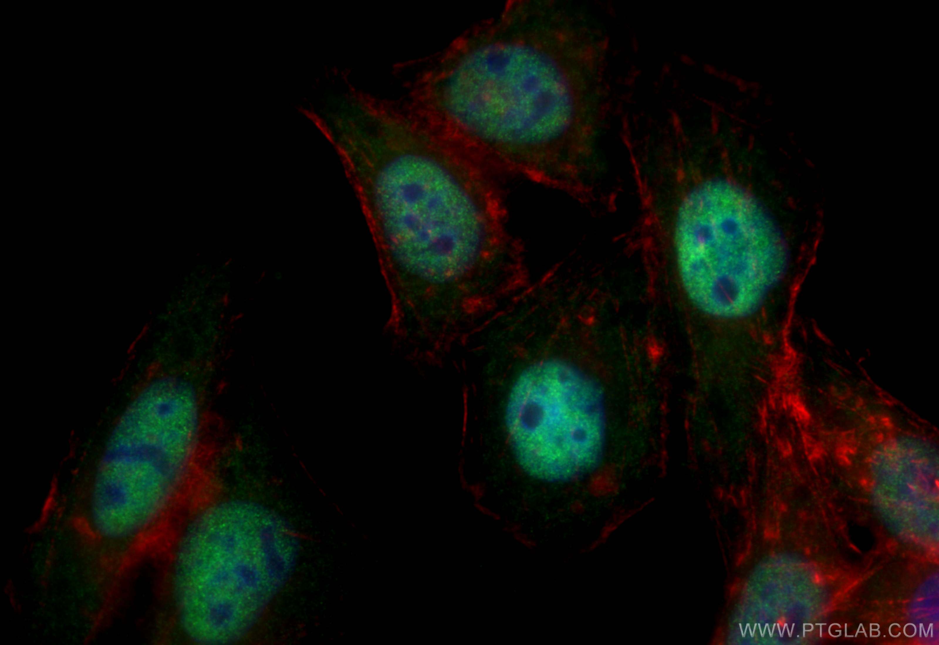 IF Staining of HepG2 using 66016-1-Ig (same clone as 66016-1-PBS)