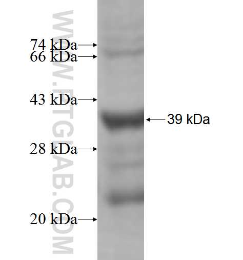 TKTL1 fusion protein Ag5148 SDS-PAGE TKTL1 fusion protein Ag5148 SDS-PAGE