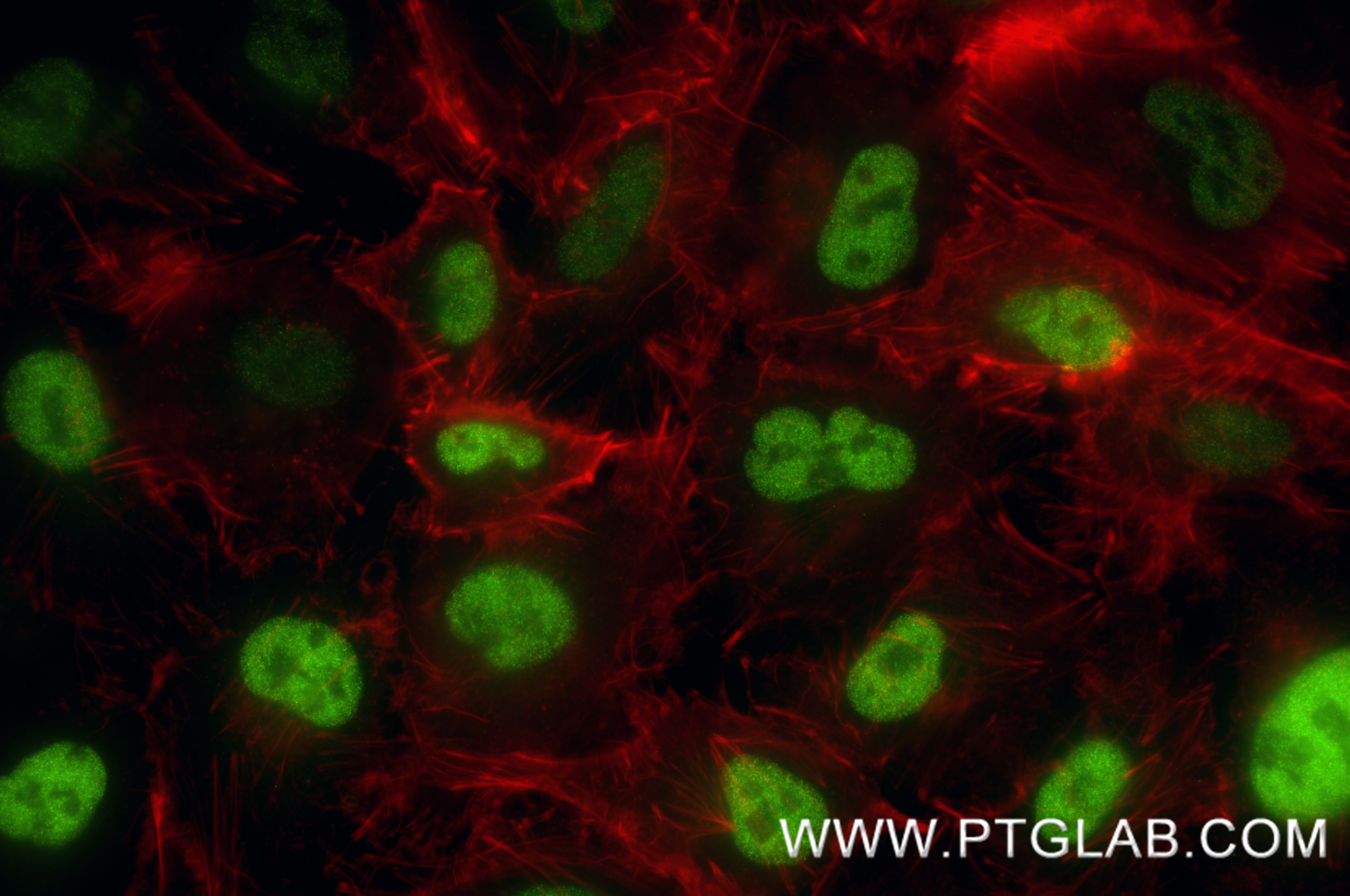 IF Staining of A549 using 87332-1-RR (same clone as 87332-1-PBS) IF Staining of A549 using 87332-1-RR (same clone as 87332-1-PBS)