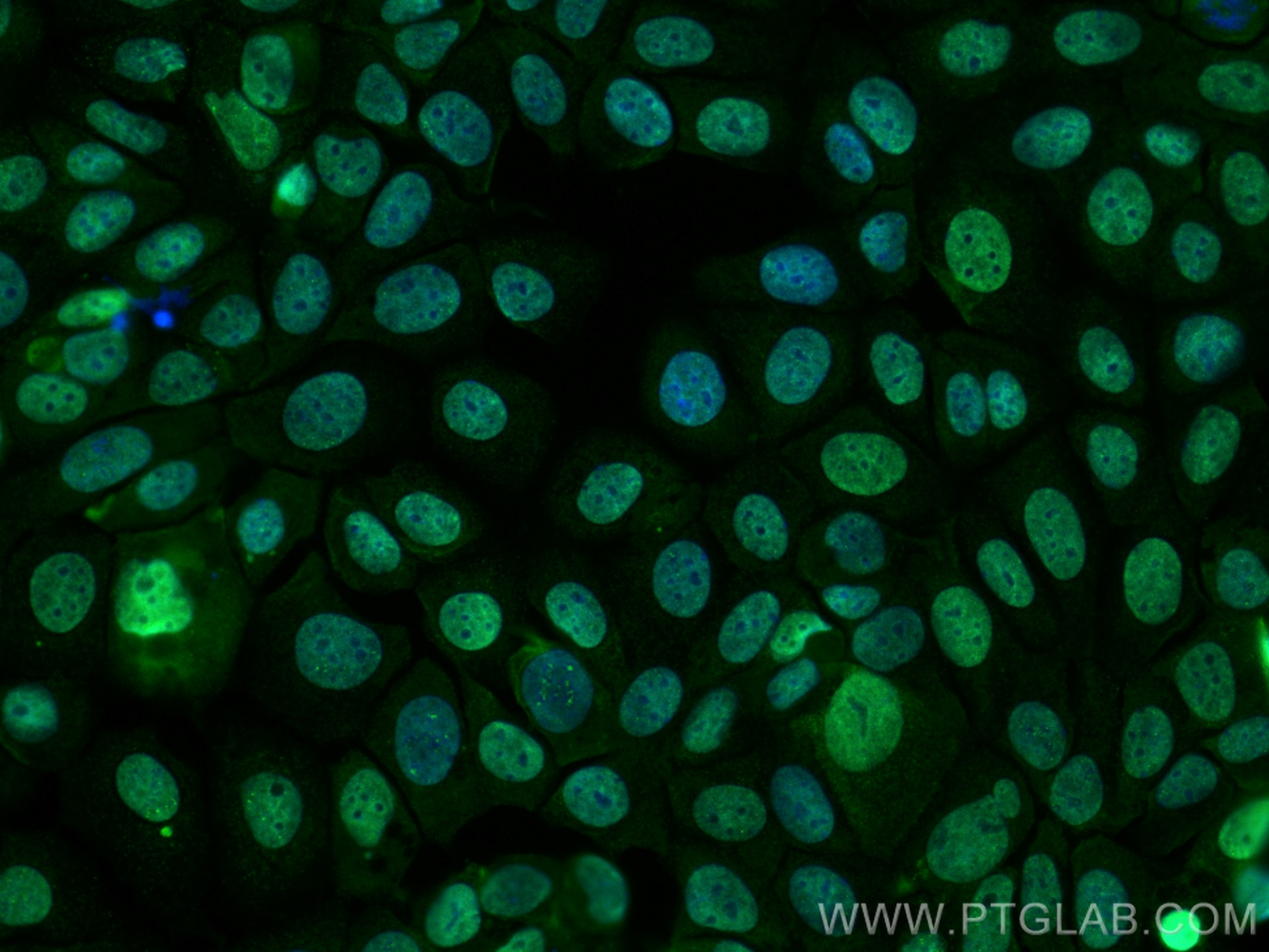 IF Staining of MCF-7 using CL488-66216