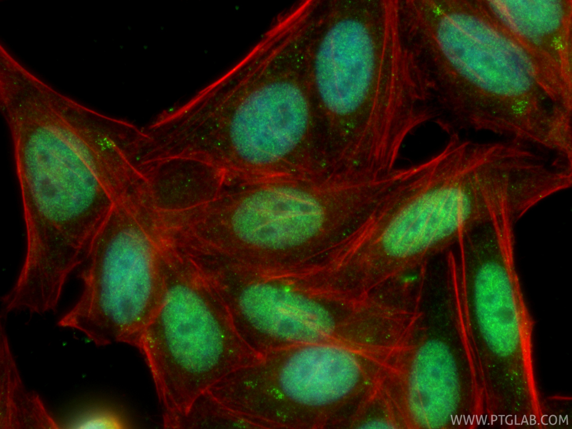 IF Staining of HepG2 using 11372-1-AP