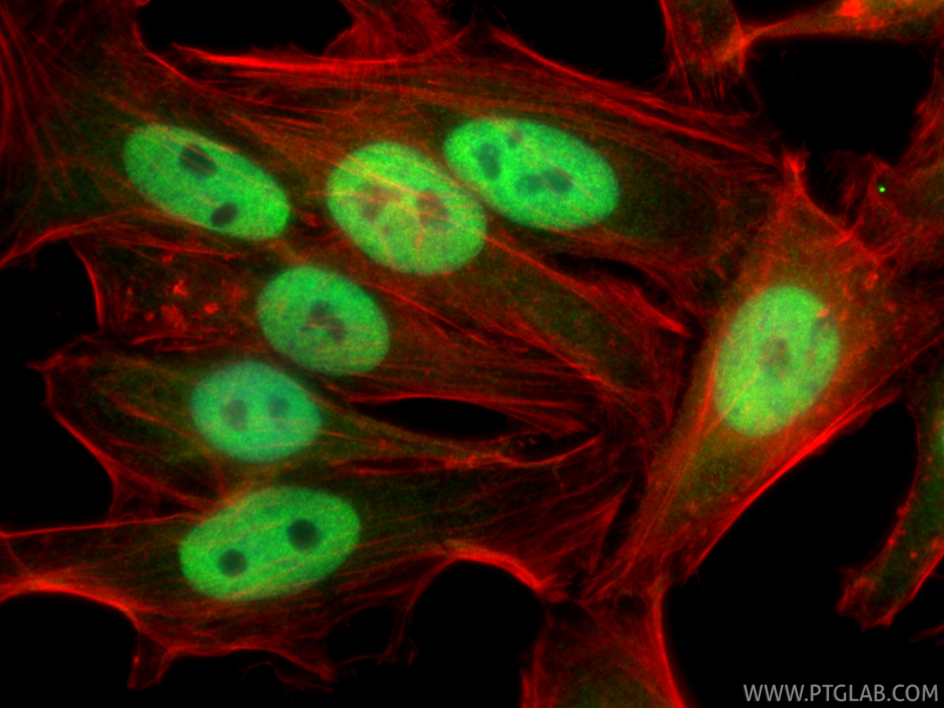 IF Staining of HepG2 using 11372-1-AP