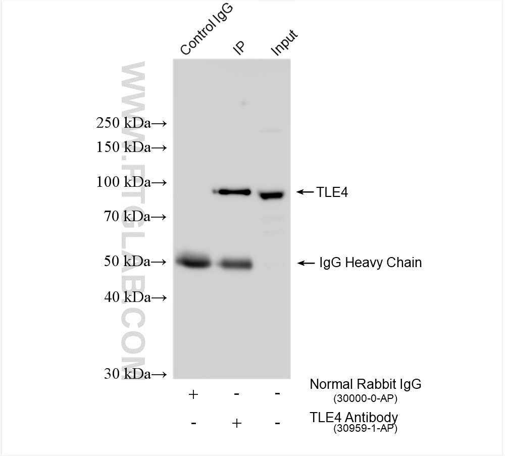 IP experiment of K-562 using 30959-1-AP