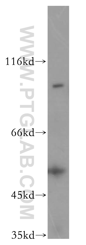 WB analysis of HeLa using 13564-1-AP
