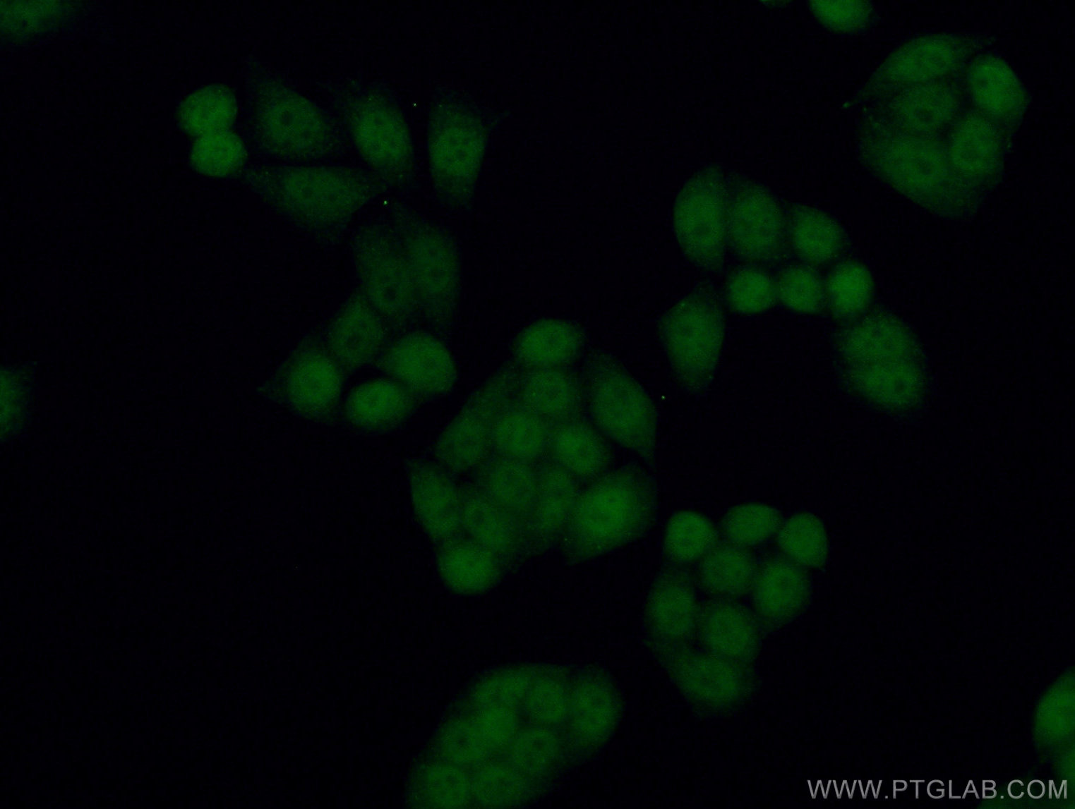 IF Staining of HeLa using 13979-1-AP