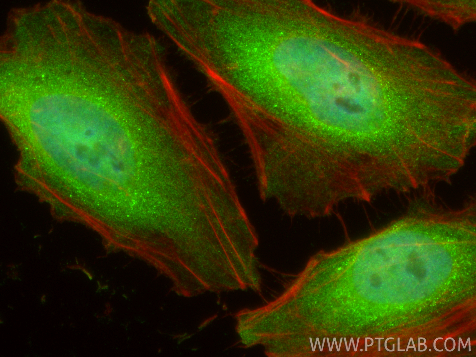 IF Staining of HeLa using 13979-1-AP IF Staining of HeLa using 13979-1-AP