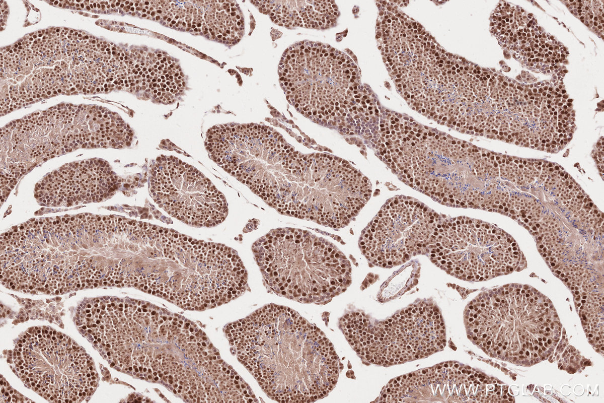 IHC staining of mouse testis using 13979-1-AP
