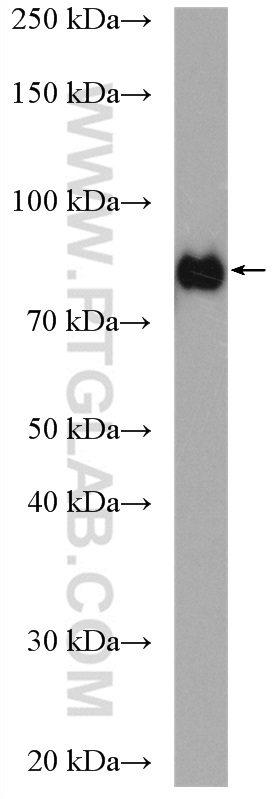 WB analysis of MCF-7 using 13979-1-AP