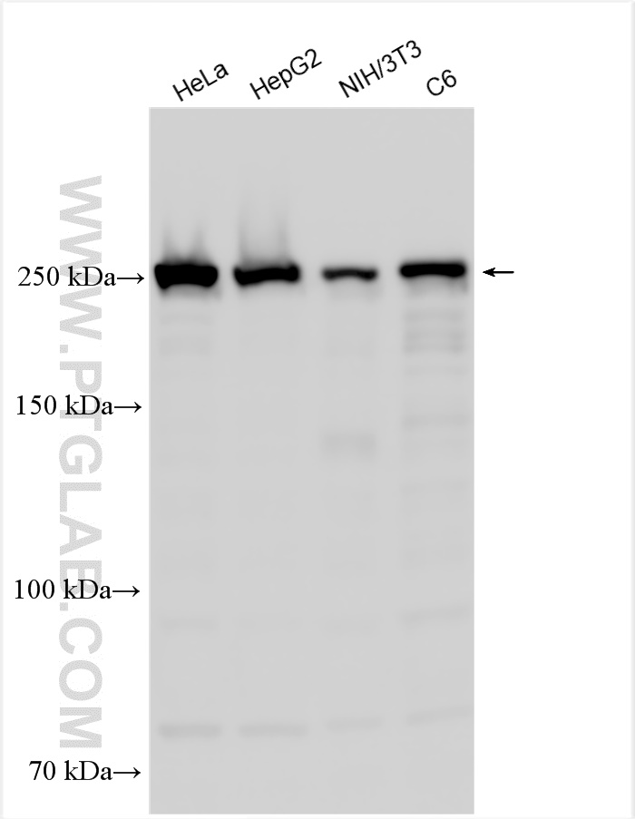 Talin1 antibody (141681AP) Proteintech 武汉三鹰生物技术有限公司