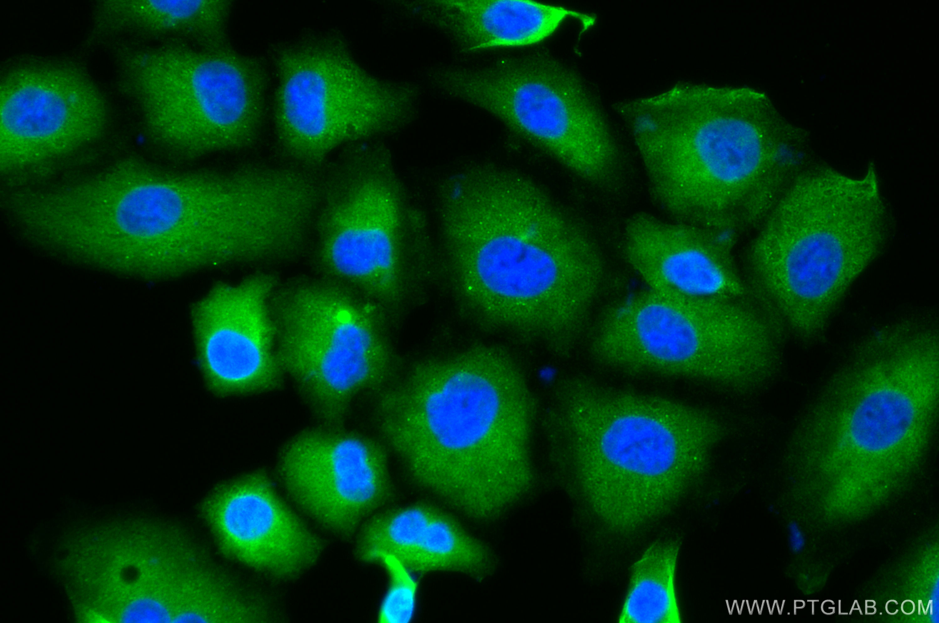 IF Staining of A549 using 67992-1-Ig (same clone as 67992-1-PBS)