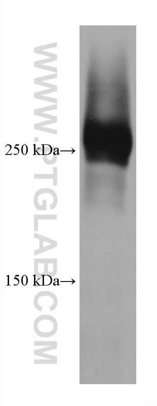 Talin-1