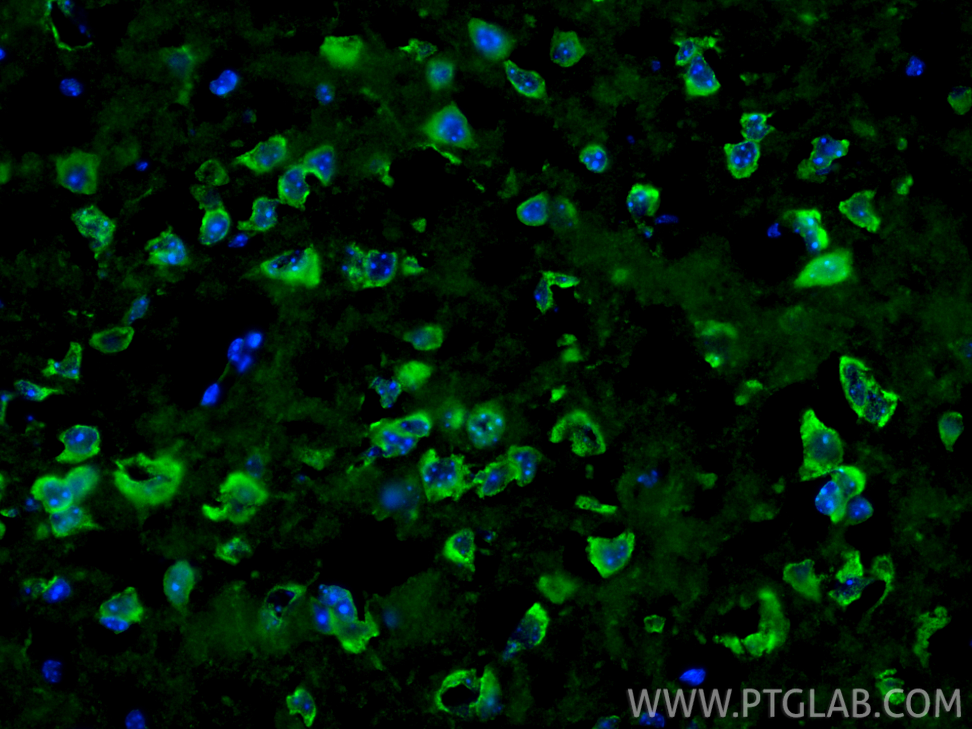 IF Staining of mouse brain using 31695-1-AP (same clone as 31695-1-PBS)