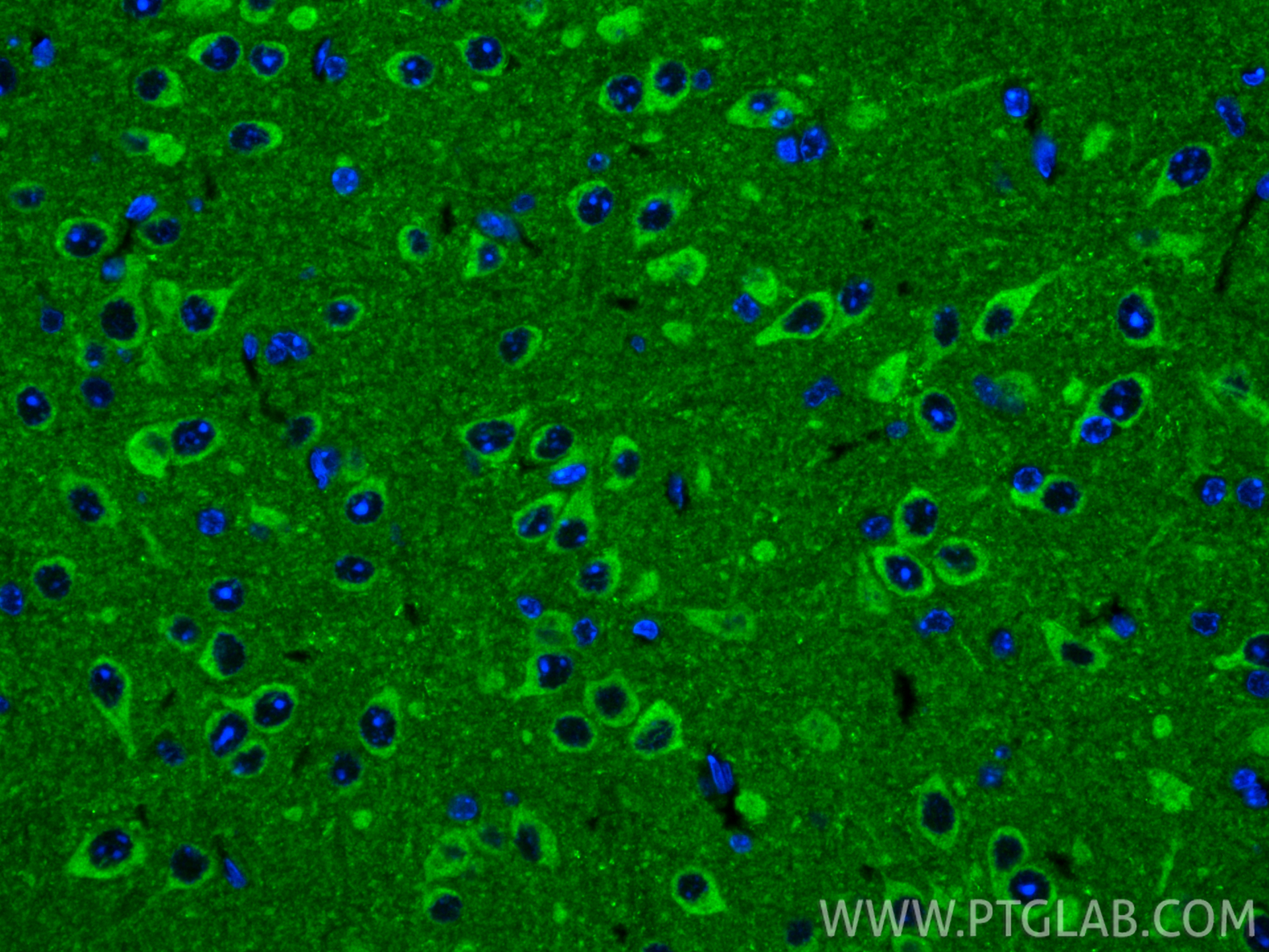 IF Staining of mouse brain using 31695-1-AP (same clone as 31695-1-PBS)