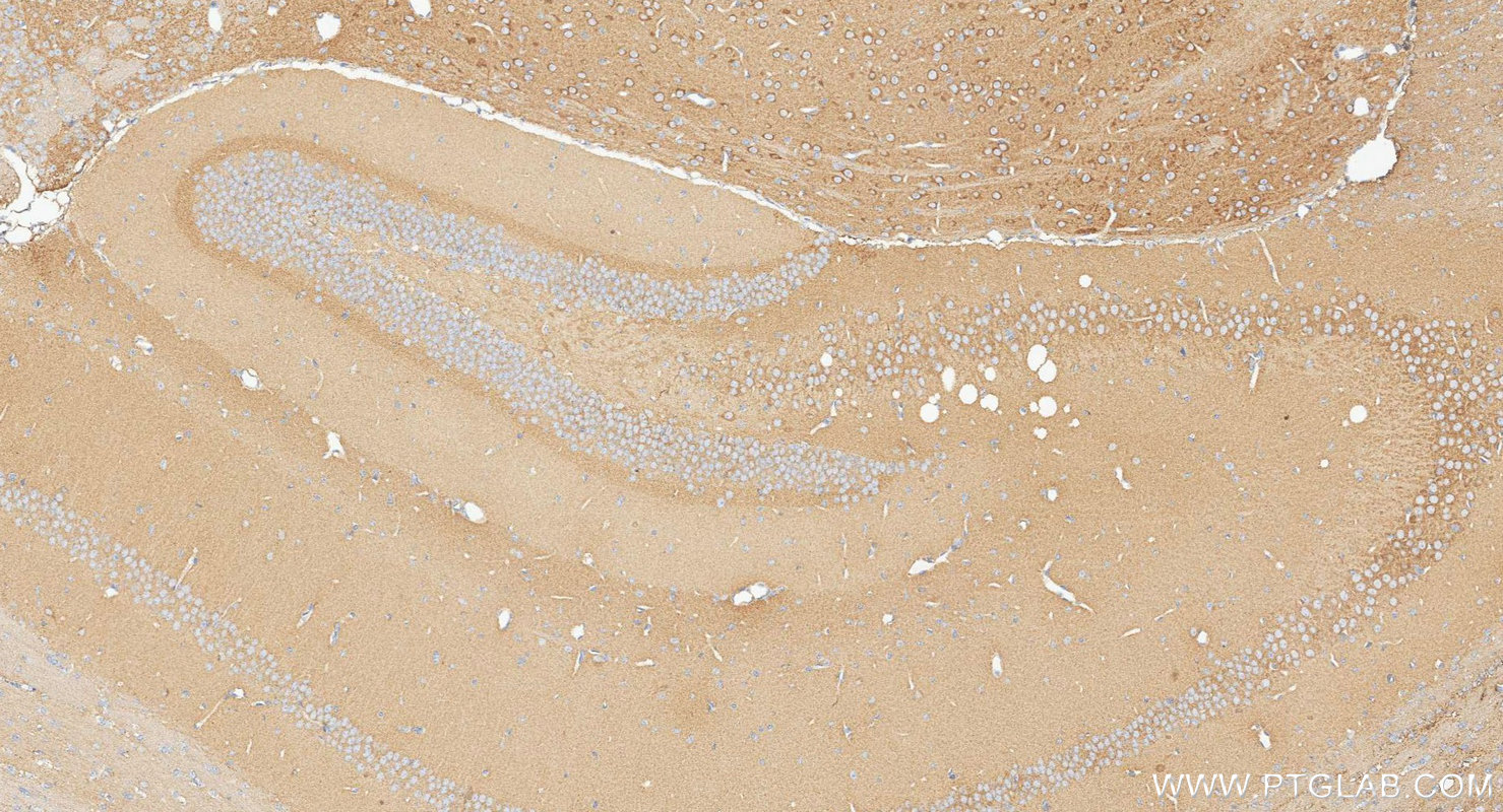 IHC staining of mouse brain using 31695-1-AP (same clone as 31695-1-PBS)