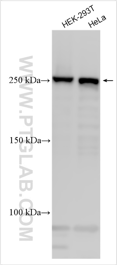 WB analysis using 31695-1-AP