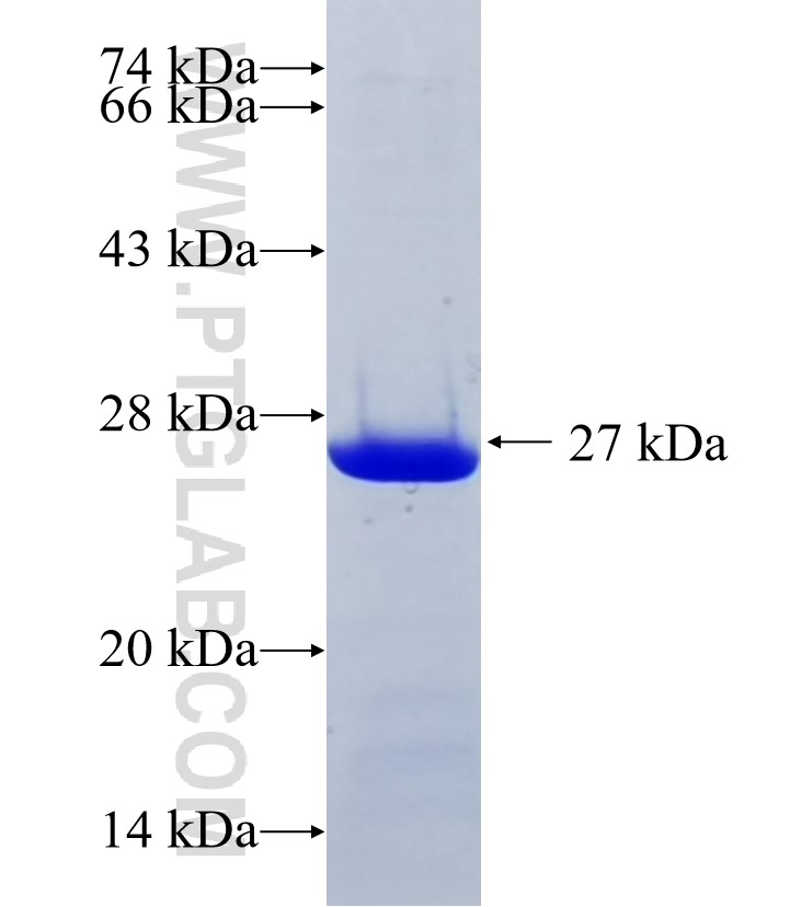 TLN2 fusion protein Ag36251 SDS-PAGE TLN2 fusion protein Ag36251 SDS-PAGE