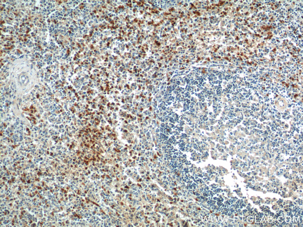 IHC staining of human spleen using 19816-1-AP