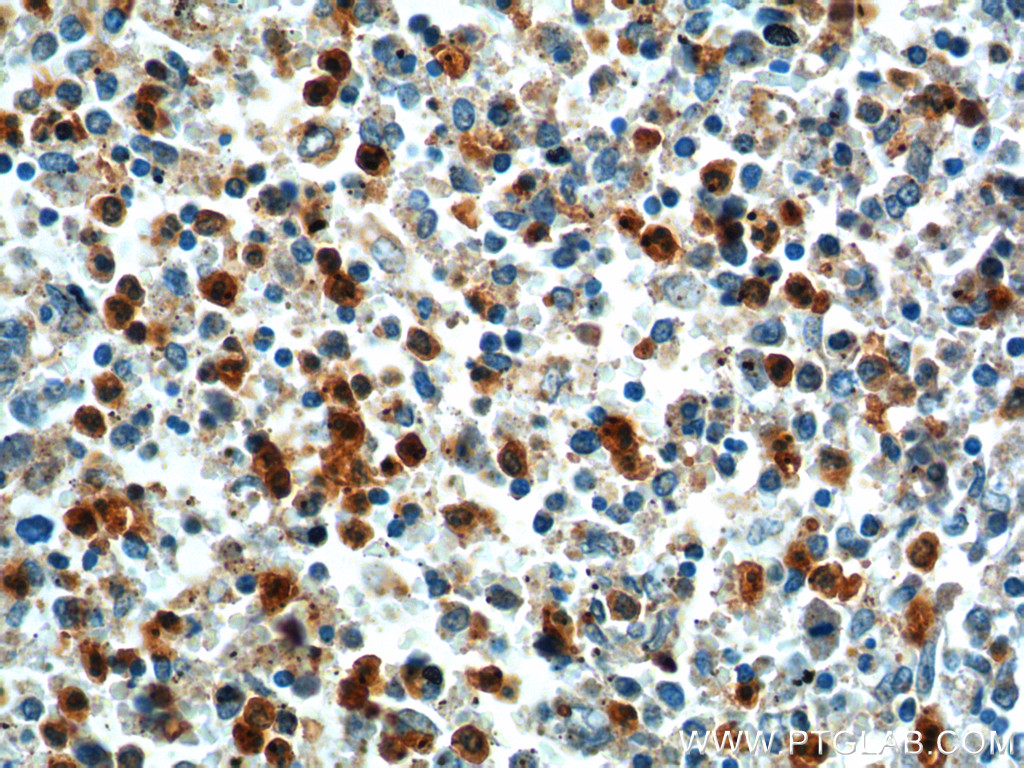 IHC staining of human spleen using 19816-1-AP