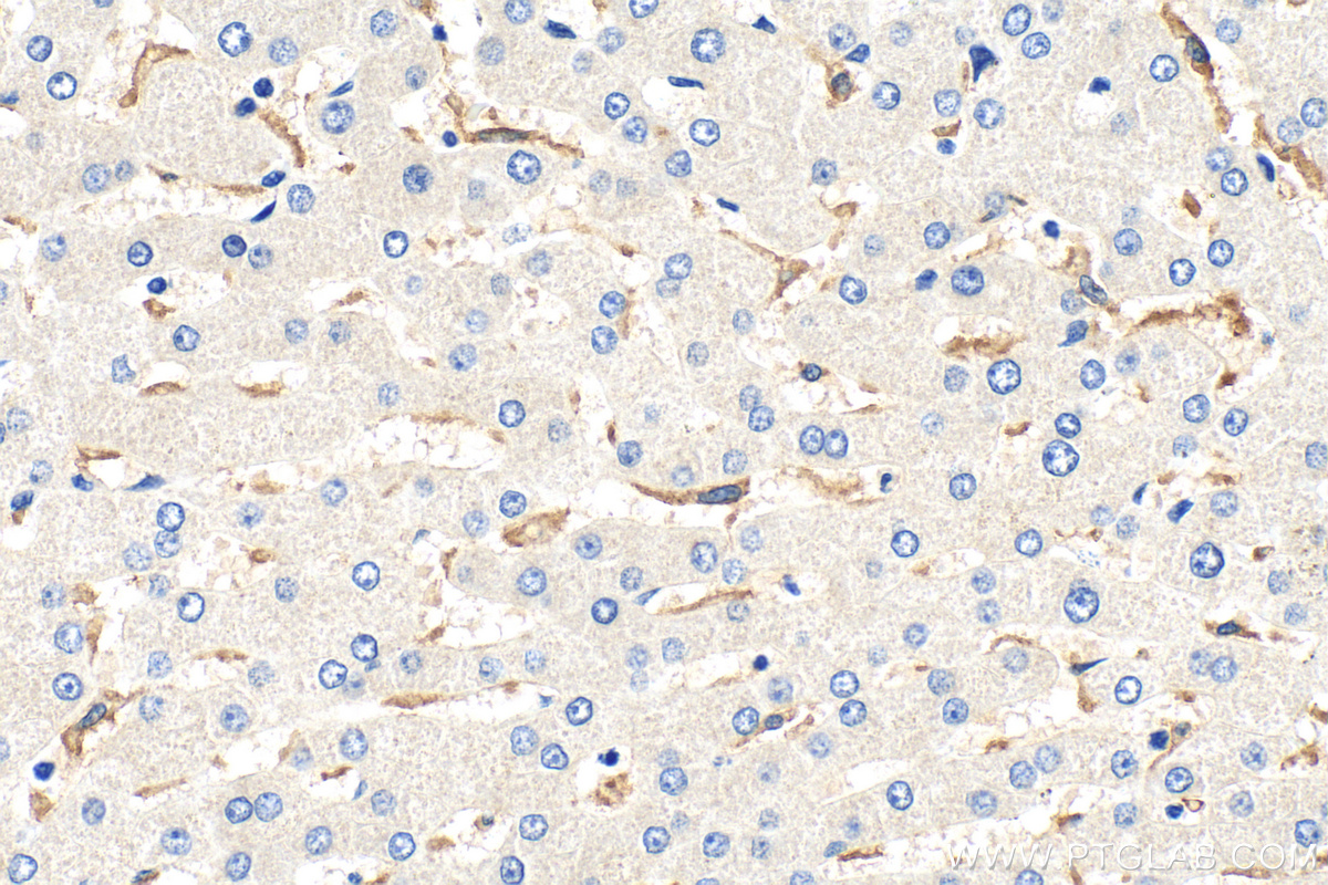 IHC staining of human liver using 66645-1-Ig (same clone as 66645-1-PBS)