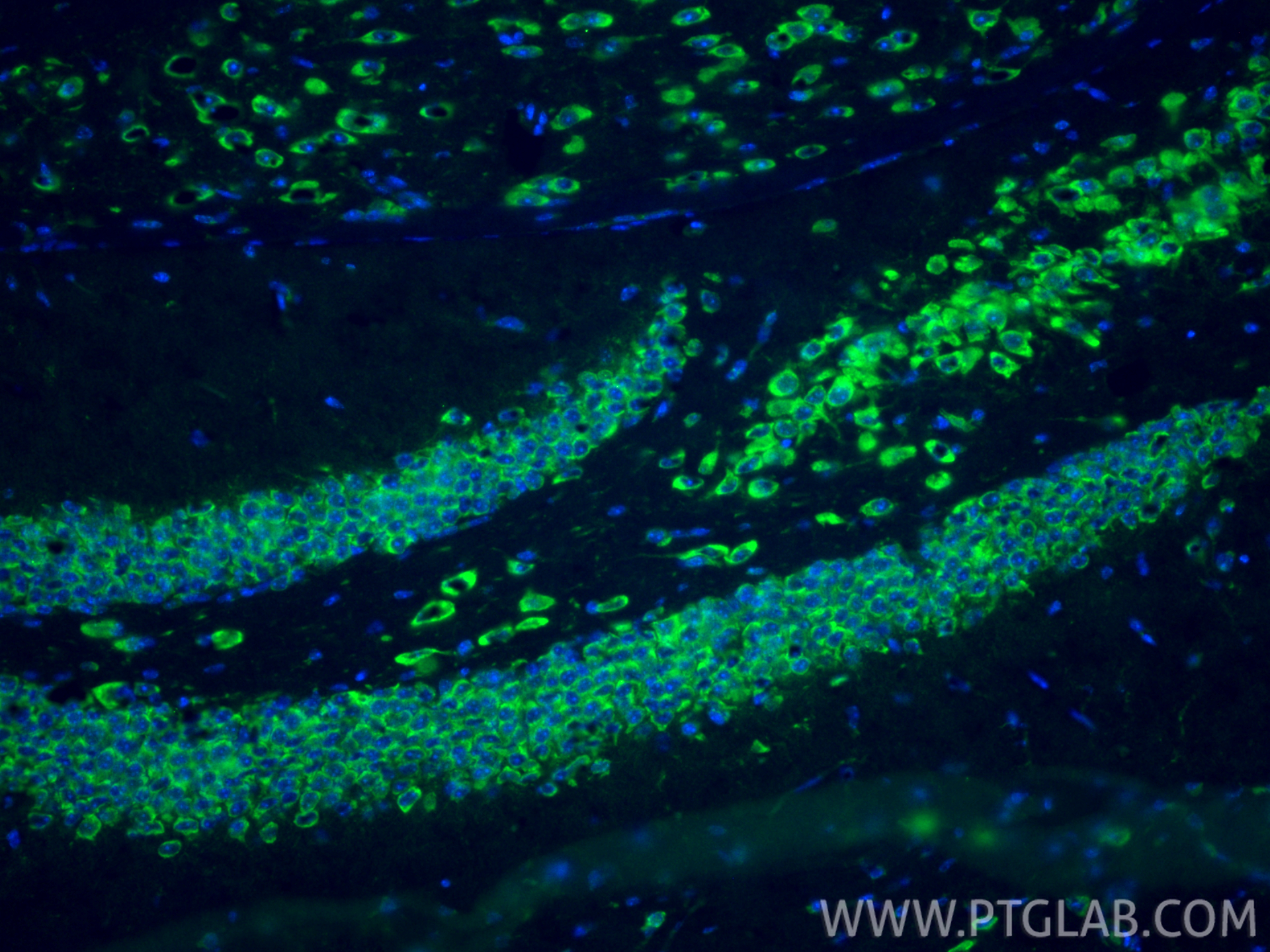 IF Staining of mouse brain using 19811-1-AP