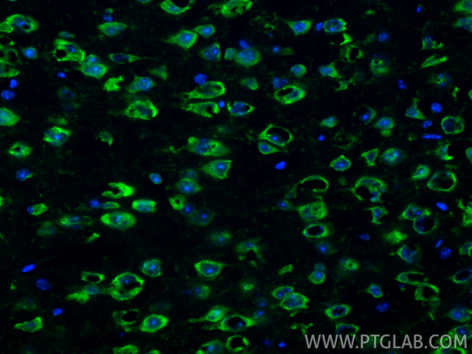 IF Staining of mouse brain using 19811-1-AP