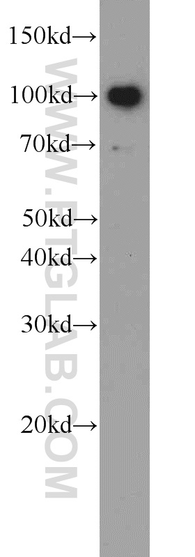 WB analysis of RAW 264.7 using 22240-1-AP