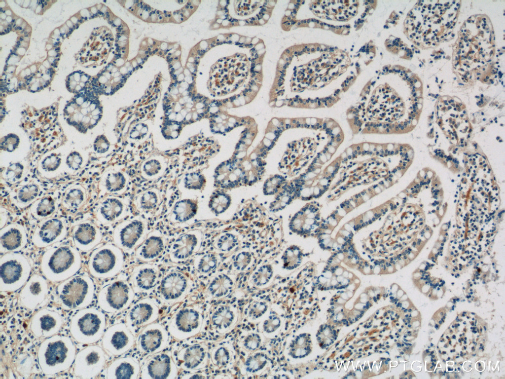 IHC staining of human small intestine using 17232-1-AP