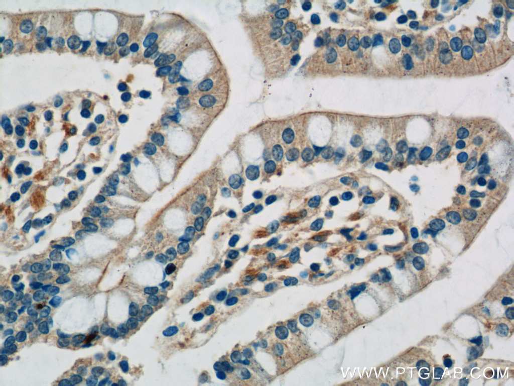 IHC staining of human small intestine using 17232-1-AP