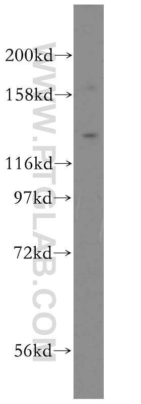 WB analysis of mouse lung using 17232-1-AP