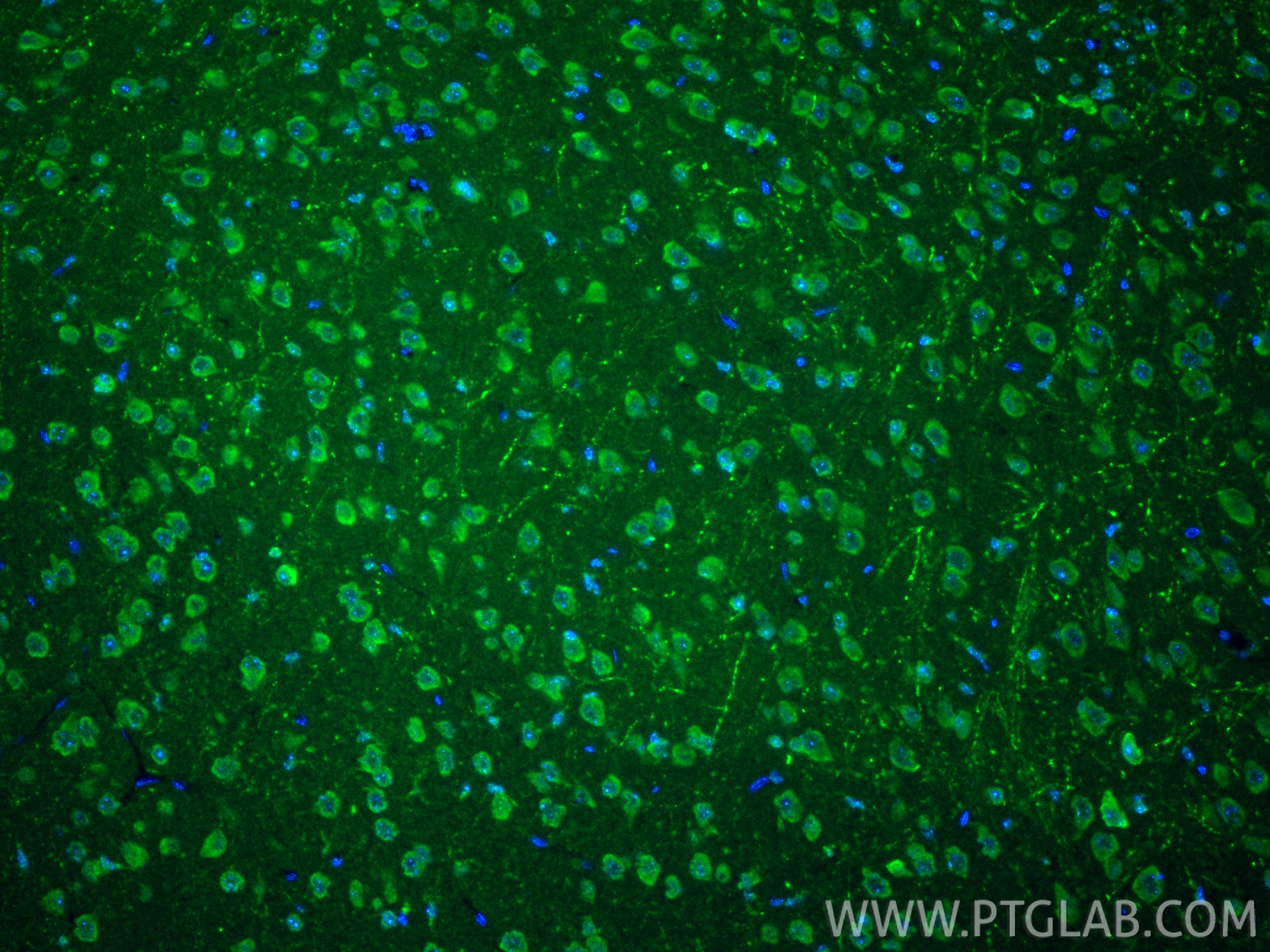 IF Staining of mouse brain using 27769-1-AP IF Staining of mouse brain using 27769-1-AP