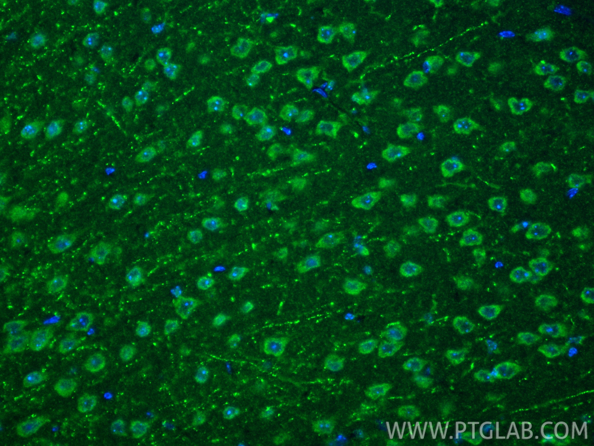 IF Staining of mouse brain using 27769-1-AP IF Staining of mouse brain using 27769-1-AP