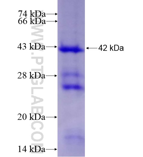 TLR9 fusion protein Ag11122 SDS-PAGE TLR9 fusion protein Ag11122 SDS-PAGE