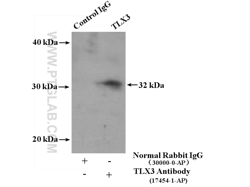 IP experiment of Jurkat using 17454-1-AP