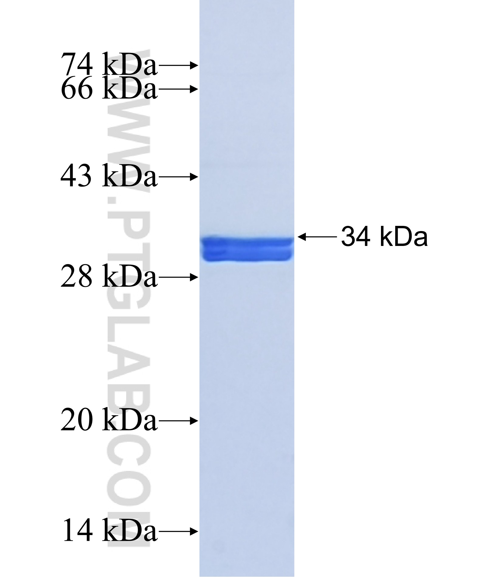 TLX3 fusion protein Ag42028 SDS-PAGE TLX3 fusion protein Ag42028 SDS-PAGE