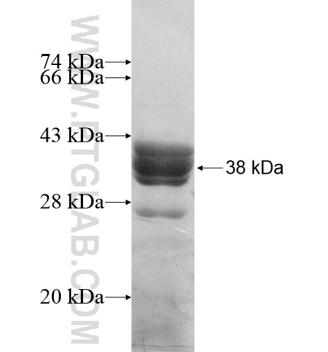 TLX3 fusion protein Ag10612 SDS-PAGE TLX3 fusion protein Ag10612 SDS-PAGE