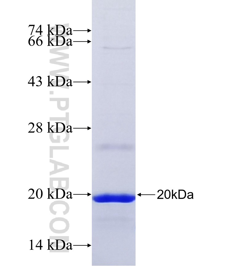 TM2D3 fusion protein Ag40007 SDS-PAGE TM2D3 fusion protein Ag40007 SDS-PAGE