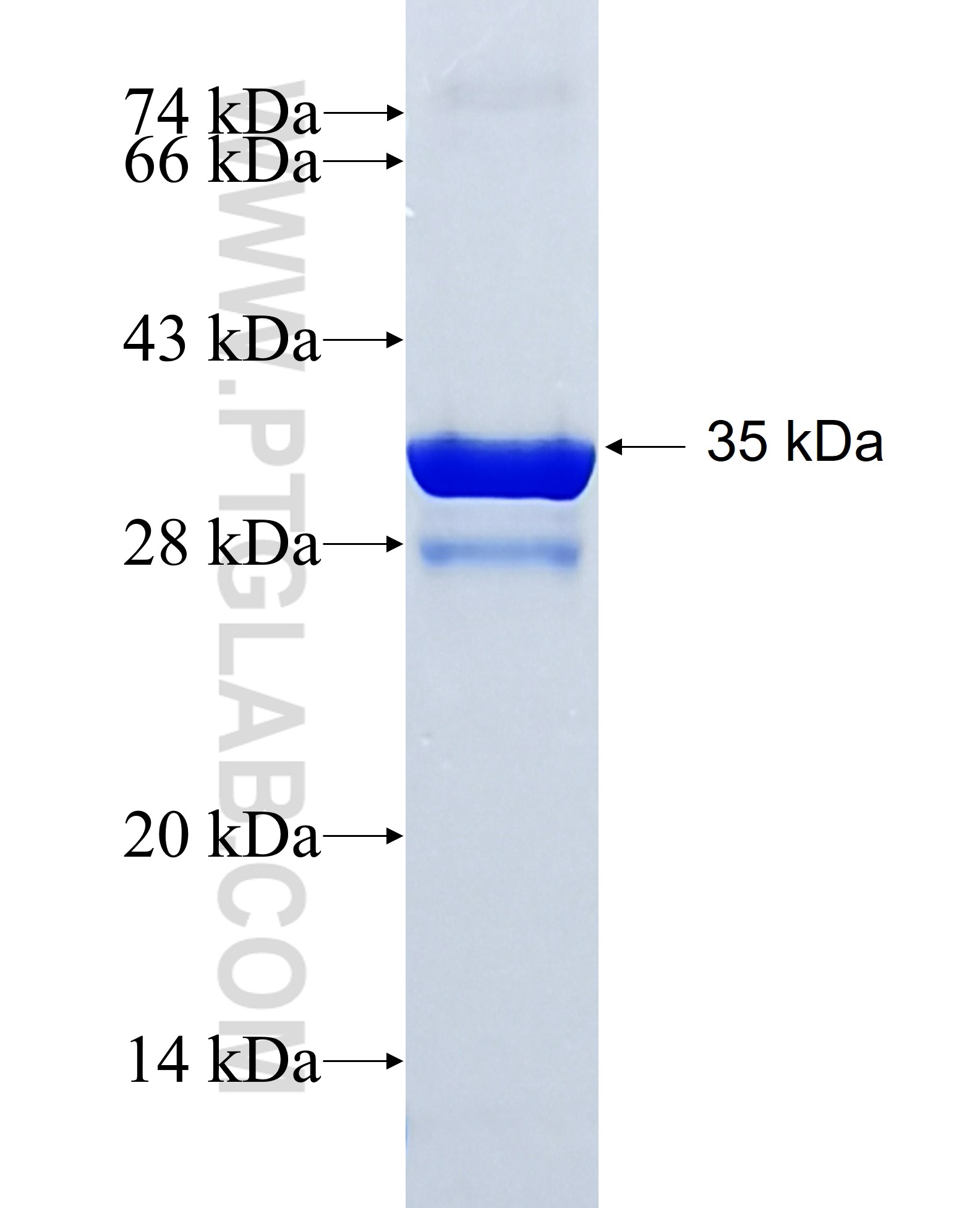 TM4SF5 fusion protein Ag13004 SDS-PAGE