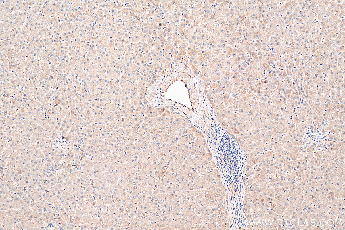 IHC staining of human liver using 27671-1-AP