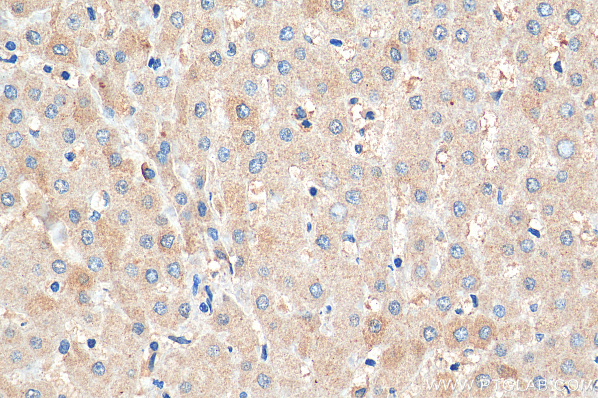 IHC staining of human liver using 27671-1-AP