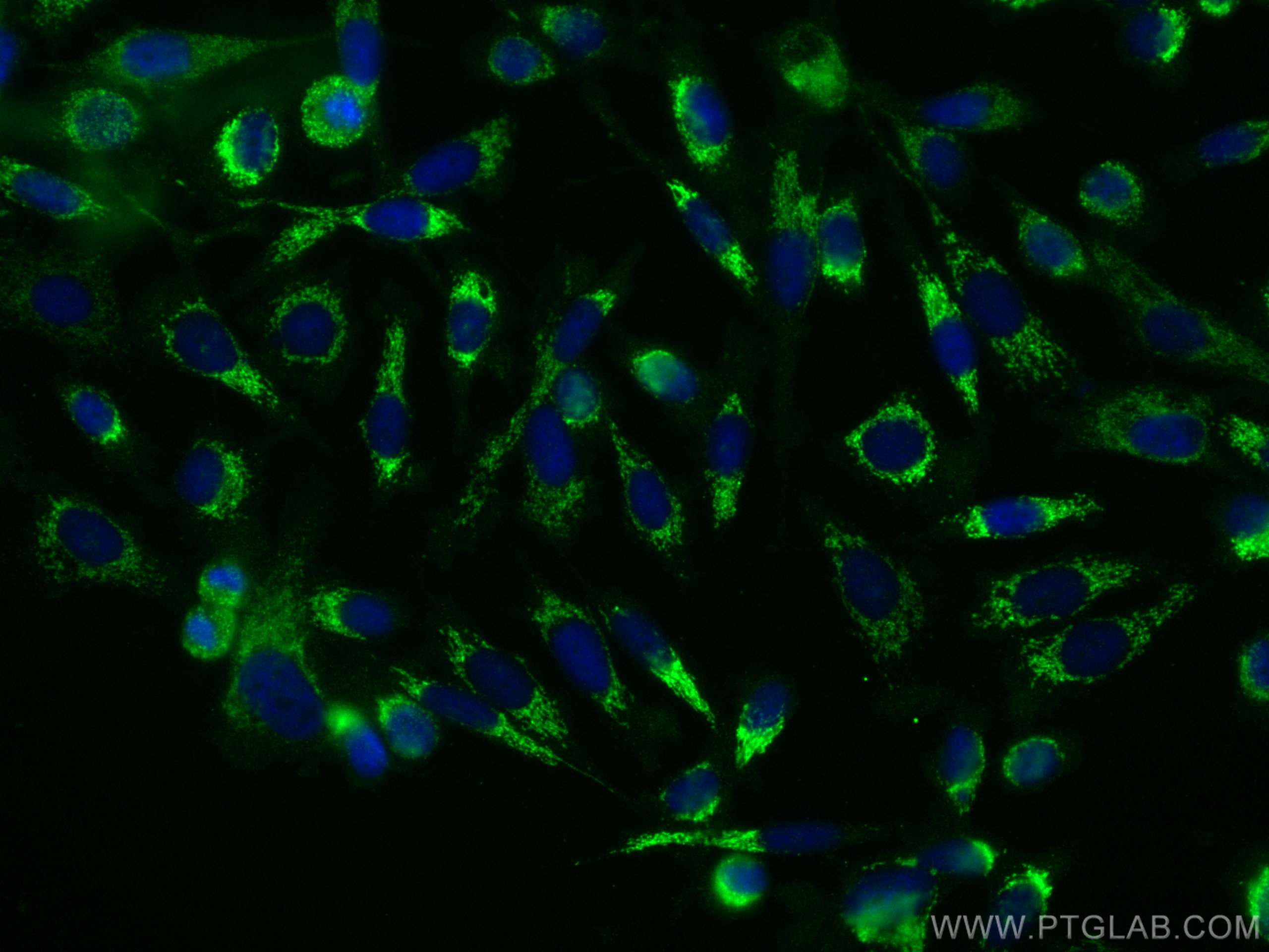 IF Staining of PC-3 using 12033-1-AP