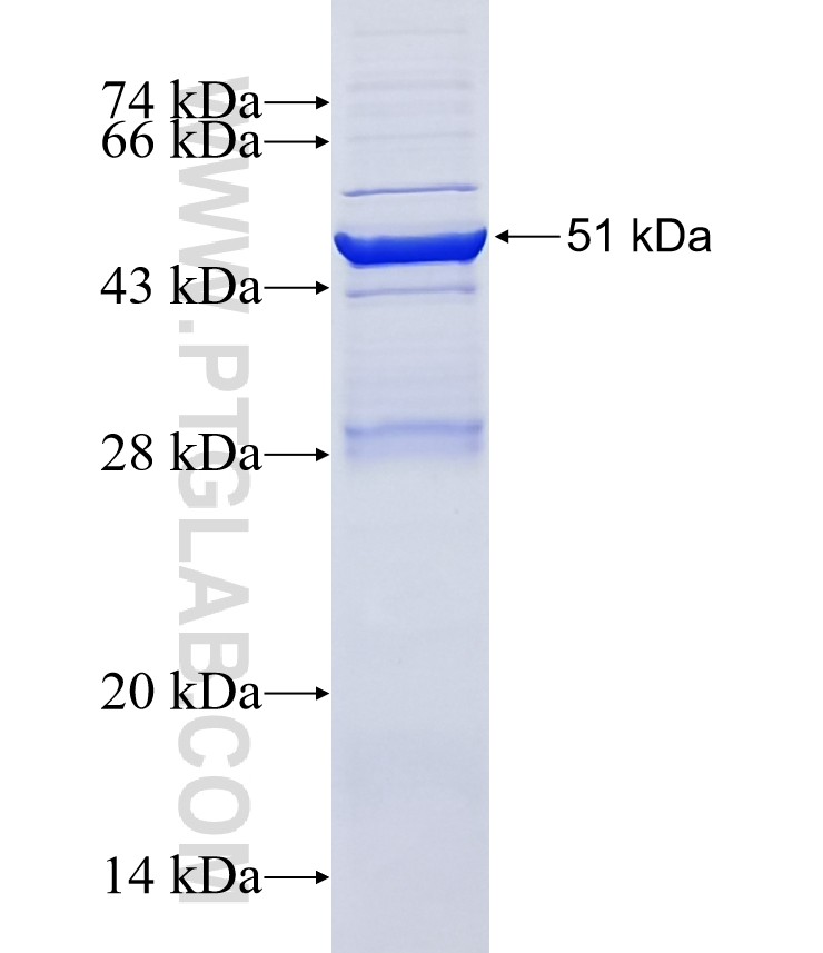 TM7SF2 fusion protein Ag2637 SDS-PAGE