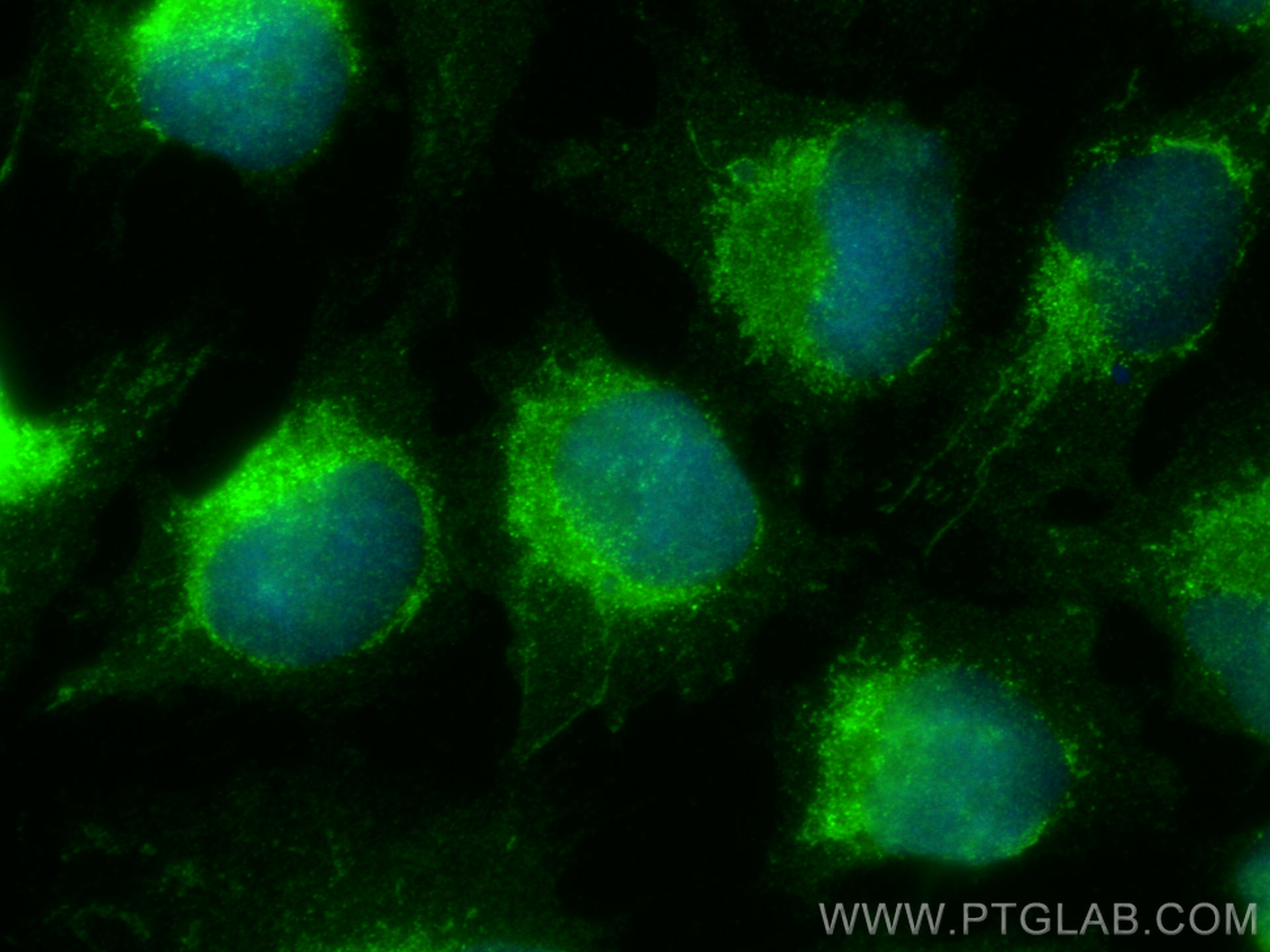 IF Staining of U-251 using 19826-1-AP