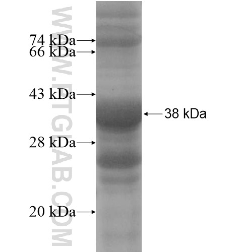 TM7SF3 fusion protein Ag13951 SDS-PAGE TM7SF3 fusion protein Ag13951 SDS-PAGE