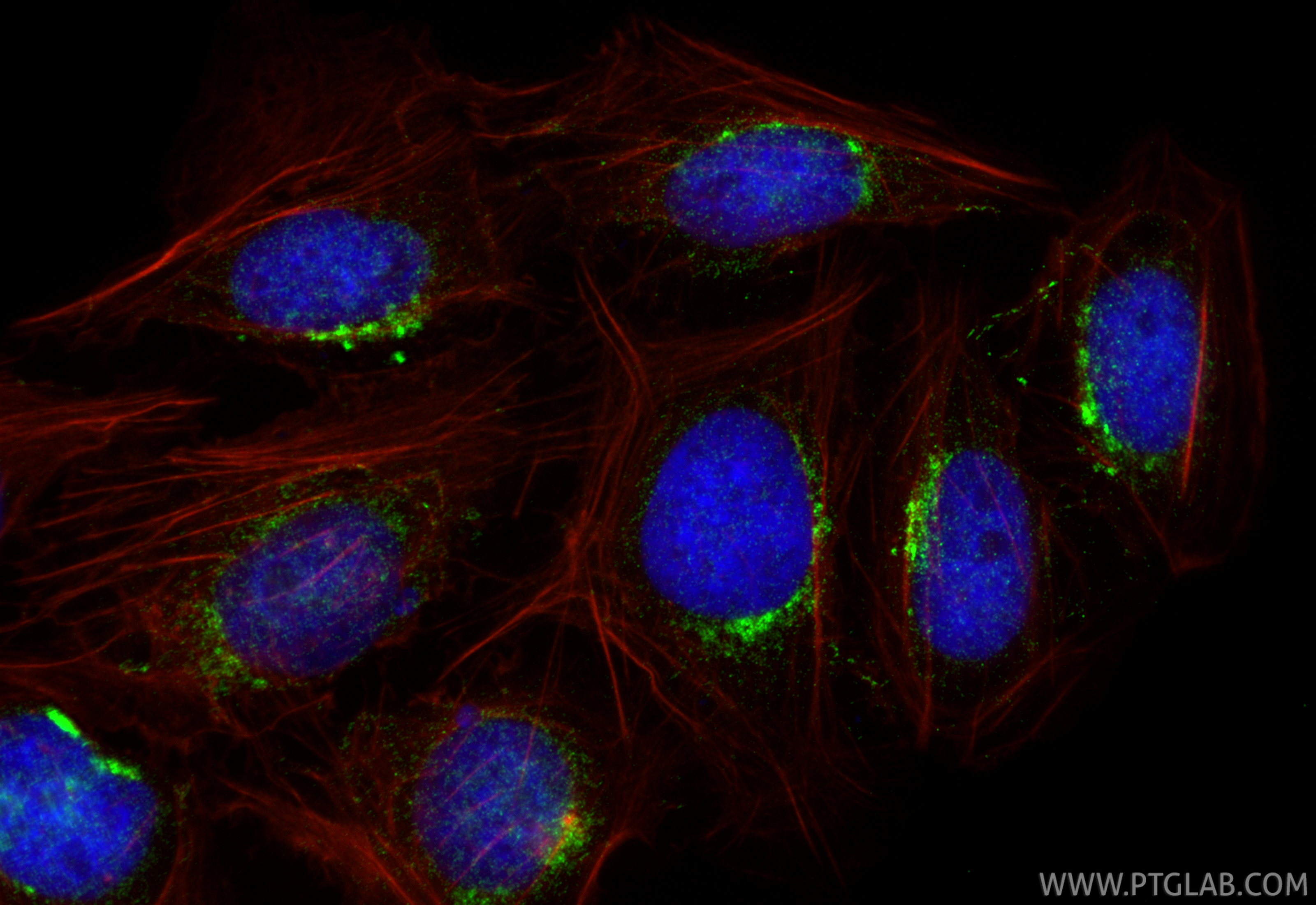 IF Staining of U2OS using 16893-1-AP (same clone as 16893-1-PBS)