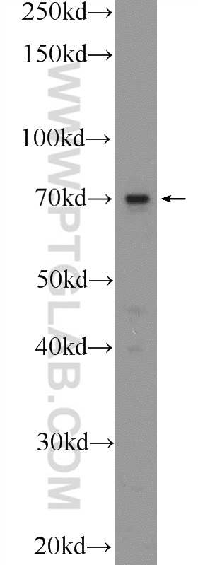 WB analysis of A431 using 25595-1-AP
