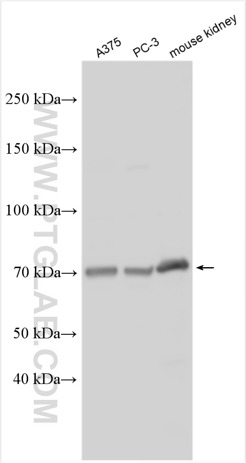 WB analysis using 29520-1-AP