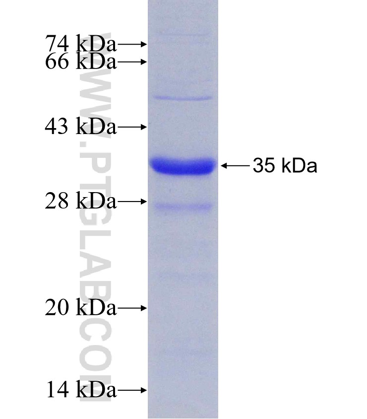 TM9SF4 fusion protein Ag22381 SDS-PAGE