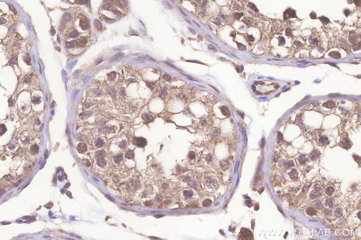 IHC staining of human testis using 26782-1-AP IHC staining of human testis using 26782-1-AP